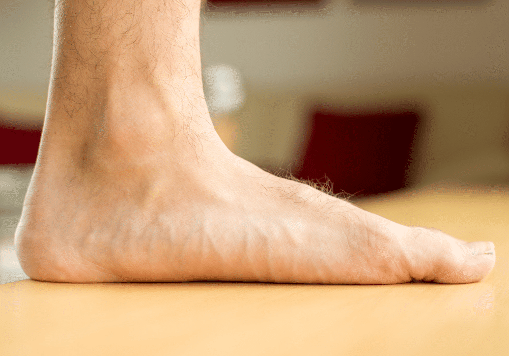 Pronation And Flat Feet Foot Mechanics