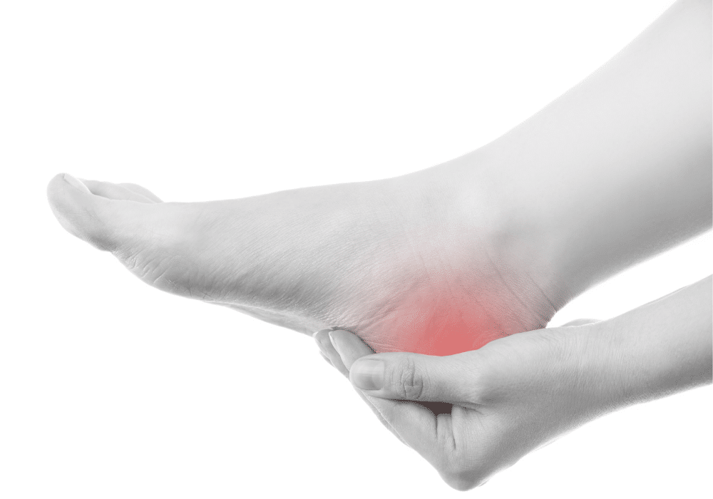 Heel Pain | Plantar Fasciitis Causes, Prevention and Treatment