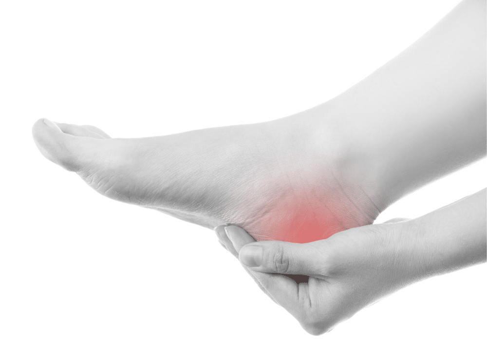 intermittent heel pain